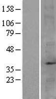 FBP2 Human Over-expression Lysate