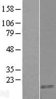 CART (CARTPT) Human Over-expression Lysate