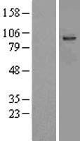 Aspartate beta hydroxylase (ASPH) Human Over-expression Lysate