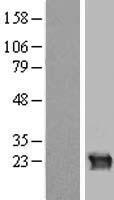 CRYGB Human Over-expression Lysate