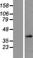 JUND Human Over-expression Lysate