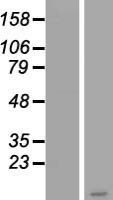 PSCA Human Over-expression Lysate