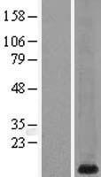 MT1G Human Over-expression Lysate