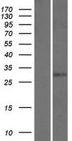 CPSF30 (CPSF4) Human Over-expression Lysate