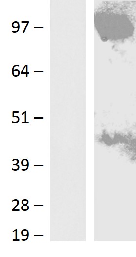 GPAM Human Over-expression Lysate