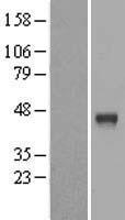 Cathepsin B (CTSB) Human Over-expression Lysate