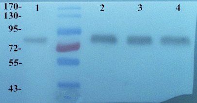 MMP9 antibody