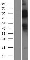 LDL Receptor (LDLR) Human Over-expression Lysate