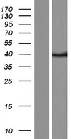 Caspase 12 (CASP12) Human Over-expression Lysate