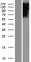 FLVCR2 Human Over-expression Lysate