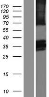 BTN2A2 Human Over-expression Lysate