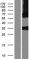 SIRT5 Human Over-expression Lysate