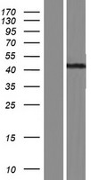CD1E Human Over-expression Lysate