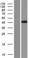 Aprataxin (APTX) Human Over-expression Lysate