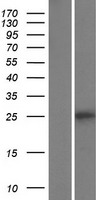 TLCD5 Human Over-expression Lysate
