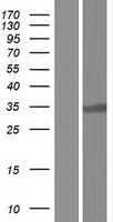 C16orf57 (USB1) Human Over-expression Lysate