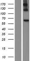 Acyloxyacyl Hydrolase (AOAH) Human Over-expression Lysate