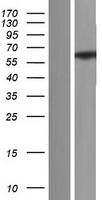 ZNF75 (ZNF75D) Human Over-expression Lysate