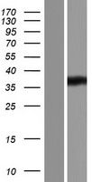 HADHSC (HADH) Human Over-expression Lysate