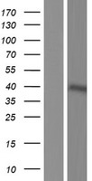 FCRLM1 (FCRLA) Human Over-expression Lysate