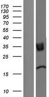 TMIGD2 Human Over-expression Lysate