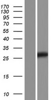 TMED5 Human Over-expression Lysate