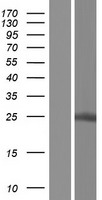C19orf50 (KXD1) Human Over-expression Lysate