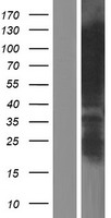 EWSR1 Human Over-expression Lysate