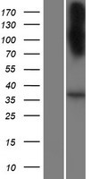 SLC22A20P Human Over-expression Lysate