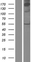 CSAD Human Over-expression Lysate