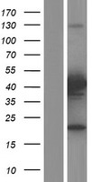 PRMT6 Human Over-expression Lysate