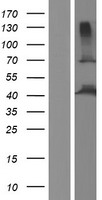 WDR51A (POC1A) Human Over-expression Lysate