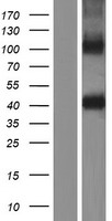 ZPBP1 (ZPBP) Human Over-expression Lysate