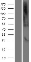 C21orf62 Human Over-expression Lysate