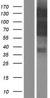 Myocardin (MYOCD) Human Over-expression Lysate