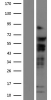 TCF7L2 Human Over-expression Lysate