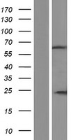 IQCC Human Over-expression Lysate