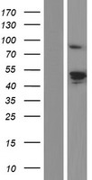 RRM2 Human Over-expression Lysate