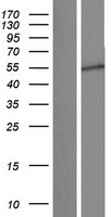 JMJD4 Human Over-expression Lysate
