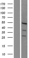 TCF7L2 Human Over-expression Lysate