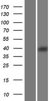 Sex Hormone Binding Globulin (SHBG) Human Over-expression Lysate