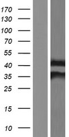 NAT1 Human Over-expression Lysate