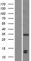 SHOX2 Human Over-expression Lysate