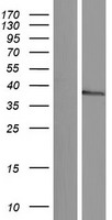 NKX1-2 Human Over-expression Lysate