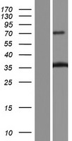 Collagen XI alpha 2 (COL11A2) Human Over-expression Lysate