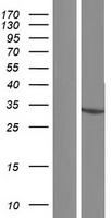 HSDL1 Human Over-expression Lysate