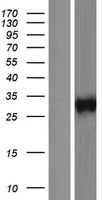 NKG2A (KLRC1) Human Over-expression Lysate