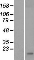 Dectin 1 (CLEC7A) Human Over-expression Lysate