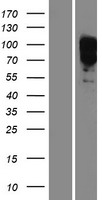 EYA1 Human Over-expression Lysate