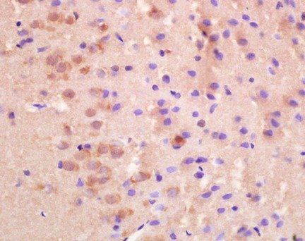 NCX2 Rabbit Polyclonal Antibody